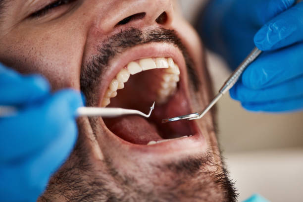Best Emergency Root Canal Therapy in Delisle, MS