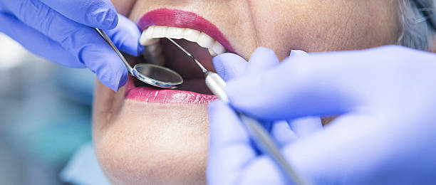 Best Knocked-Out Tooth (Avulsed Tooth) Treatment in Delisle, MS